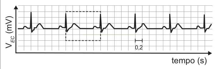 Gráfico de linha em forma de eletrocardiograma, com tensão V_EC em milivolts ao longo do tempo, e marcação de escala 0,2.