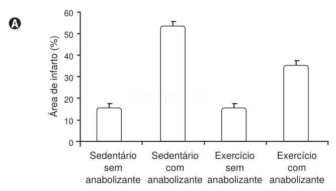 Gráfico de barras da área de infarto (%) em quatro grupos, combinando sedentarismo ou exercício e uso ou não de anabolizante.