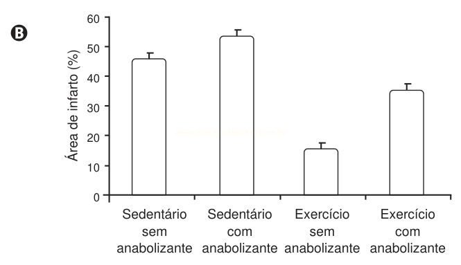 Gráfico de barras comparando a área de infarto (%) em quatro grupos: sedentário e exercício, com e sem anabolizante.
