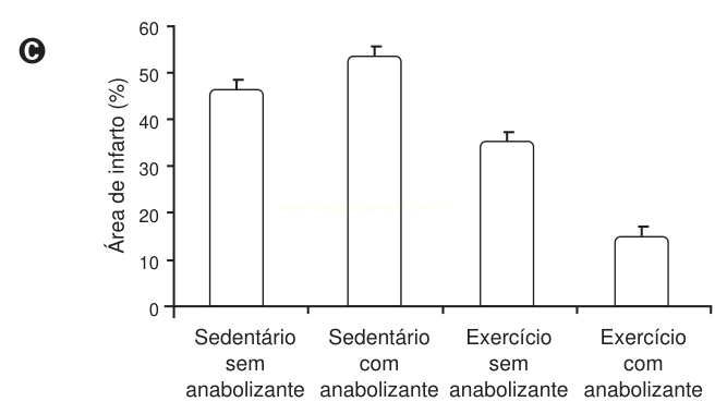 Gráfico de barras da área de infarto (%) em quatro grupos, com a menor taxa no grupo exercício com anabolizante.